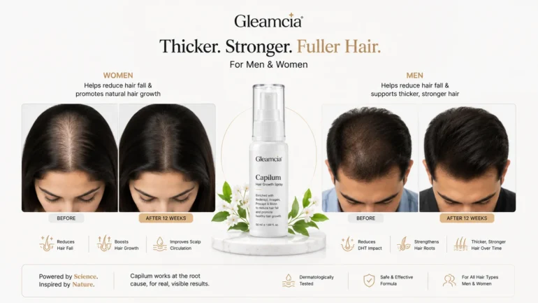 Capilum hair growth spray for men and women with thinning hair and hair fall