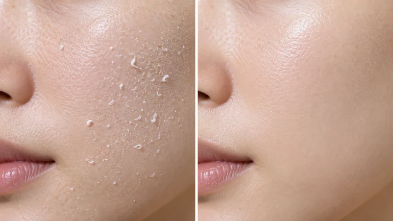 What is sunscreen pilling — sunscreen balling up under makeup vs correctly absorbed SPF formula