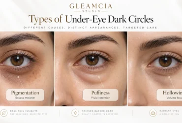 Can Eye Cream Fix Dark Circles? | What Works, What Doesn’t & How to Treat Them 